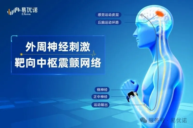特发性震颤：一个被忽视的